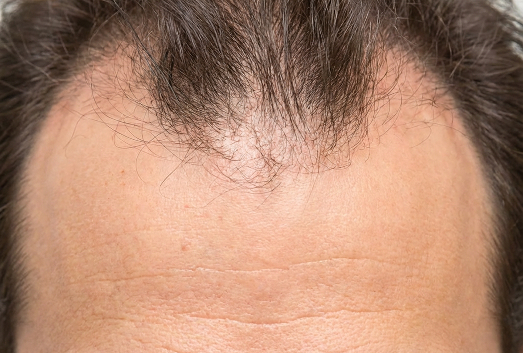 Линия роста